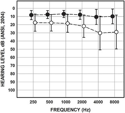 Vestibular and balance function in veterans with chronic dizziness associated with mild traumatic brain injury and blast exposure